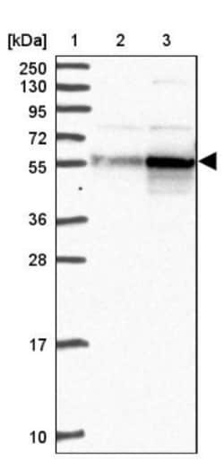 CAP2 Antibody, Novus Biologicals 0.1mL; Unlabeled:Antibodies, Polyclonal