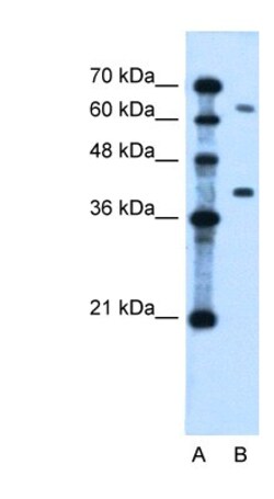 CAPC/ LRRC26 Antibody, Novus Biologicals 0.05mg; Unlabeled:Antibodies,