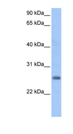 NLRP3/NALP3 Antibody (Nalpy3-b) - BSA Free, Novus Biologicals:Antibodies:Primary