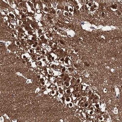 CAPRIN2 Antibody, Novus Biologicals 0.1mL; Unlabeled:Antibodies, Polyclonal