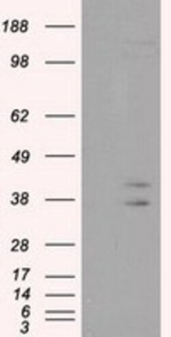 CAPZA1 Antibody (OTI2G4), Novus Biologicals 0.1mL; Unlabeled:Antibodies,