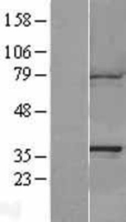 Novus Biologicals&trade;&nbsp;CAPZA1 Overexpression Lysate
