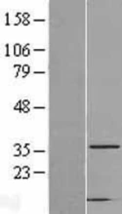 Novus Biologicals&trade;&nbsp;CAPZA2 Overexpression Lysate