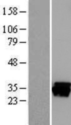 Novus Biologicals™ CAPZB Overexpression Lysate