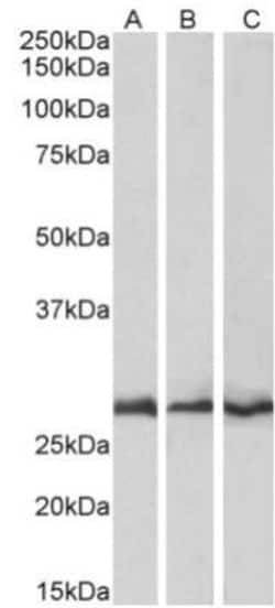 CAPZB Antibody, Novus Biologicals 0.1mg; Unlabeled:Antibodies, Polyclonal