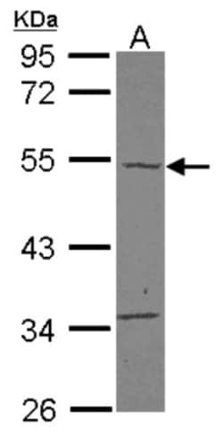 carabin Antibody, Novus Biologicals 0.1mL; Unlabeled:Antibodies, Polyclonal