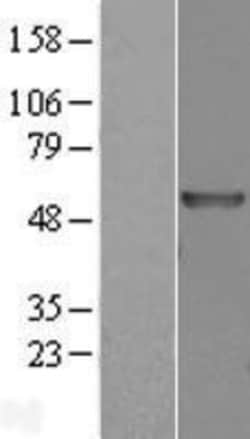 Novus Biologicals™ carabin Overexpression Lysate