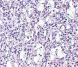 carabin Antibody - BSA Free, Novus Biologicals 0.1mg; Unlabeled:Antibodies,