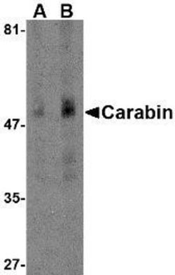 carabin Antibody - BSA Free, Novus Biologicals 0.1mg; Unlabeled:Antibodies,