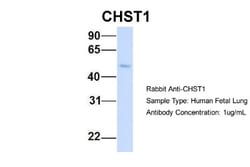 Carbohydrate Sulfotransferase 1/CHST1/KS6ST Antibody, Novus Biologicals