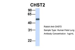 Carbohydrate Sulfotransferase 2/CHST2 Antibody, Novus Biologicals 20&mu;L;