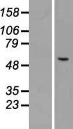 Novus Biologicals&trade;&nbsp;Carbohydrate Sulfotransferase 3/CHST3 Overexpression Lysate