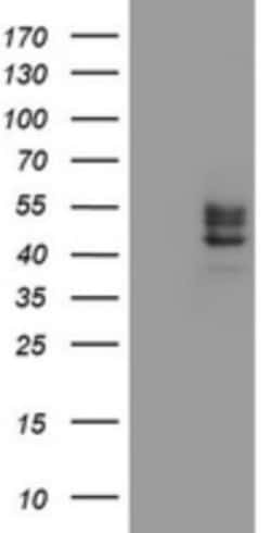 Carbohydrate Sulfotransferase 6/CHST6 Antibody (OTI1D1), Novus Biologicals