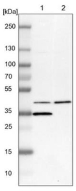 Carbohydrate Sulfotransferase 10/CHST10 Antibody, Novus Biologicals 25