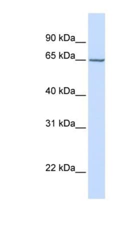 Carbohydrate Sulfotransferase 15/CHST15 Antibody, Novus Biologicals 0.05mg;