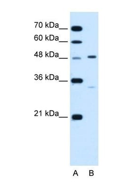 Carbohydrate Sulfotransferase 1/CHST1/KS6ST Antibody, Novus Biologicals 100 &mu;L | Buy Online | Novus Biologicals | Fisher Scientific