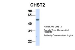 Carbohydrate Sulfotransferase 2/CHST2 Antibody, Novus Biologicals 20&mu;L;