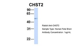 Carbohydrate Sulfotransferase 2/CHST2 Antibody, Novus Biologicals 20&mu;L;