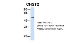 Carbohydrate Sulfotransferase 2/CHST2 Antibody, Novus Biologicals 20&mu;L;