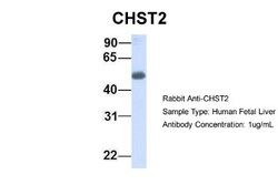 Carbohydrate Sulfotransferase 2/CHST2 Antibody, Novus Biologicals 20&mu;L;