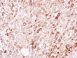 Carbohydrate Sulfotransferase 4/CHST4 Antibody, Novus Biologicals 0.1mL;