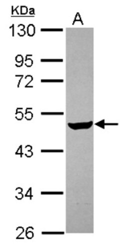 Carbohydrate Sulfotransferase 4/CHST4 Antibody, Novus Biologicals 0.1mL;
