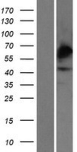 Novus Biologicals&trade;&nbsp;Carbohydrate Sulfotransferase 4/CHST4 Overexpression Lysate