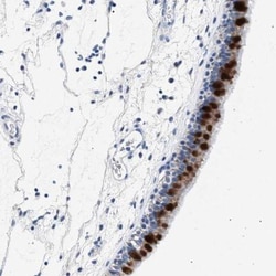 Carbohydrate Sulfotransferase 4/CHST4 Antibody, Novus Biologicals:Antibodies:Primary