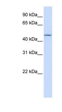 Carbohydrate Sulfotransferase 6/CHST6 Antibody, Novus Biologicals 100 &mu;L | Buy Online | Novus Biologicals | Fisher Scientific