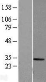 Novus Biologicals™ Carbonic Anhydrase I/CA1 Overexpression Lysate