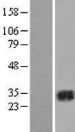 Novus Biologicals&trade;&nbsp;Carbonic Anhydrase II/CA2 Overexpression Lysate