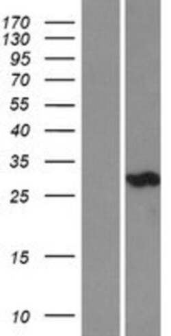 Novus Biologicals&trade;&nbsp;Carbonic Anhydrase III/CA3 Overexpression Lysate