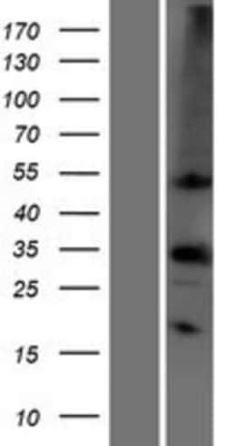 Novus Biologicals&trade;&nbsp;Carbonic Anhydrase IV/CA4 Overexpression Lysate