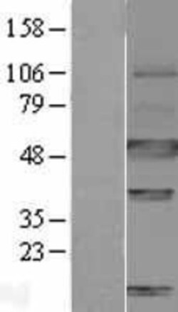 Novus Biologicals&trade;&nbsp;Carbonic Anhydrase IX/CA9 Overexpression Lysate
