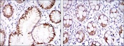Carbonic Anhydrase IX/CA9 Antibody (2D3) - BSA Free, Novus Biologicals:Antibodies:Primary