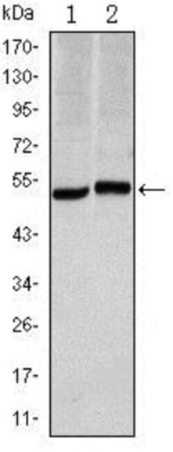 Carbonic Anhydrase IX/CA9 Antibody (2D3) - BSA Free, Novus Biologicals:Antibodies:Primary