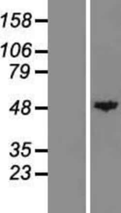 Novus Biologicals&trade;&nbsp;Carboxypeptidase A1/CPA1 Overexpression Lysate