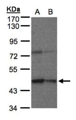 Carboxypeptidase B1/CPB1 Antibody, Novus Biologicals 0.1mg; Unlabeled:Antibodies,