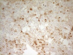 Carboxypeptidase B2/CPB2 Antibody (OTI3D5), Novus Biologicals 0.1mL; Unlabeled:Antibodies,