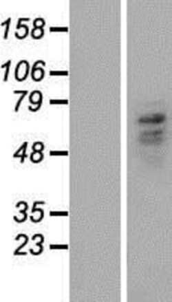 Novus Biologicals&trade;&nbsp;Carboxypeptidase M Overexpression Lysate