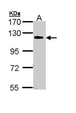 CARD10 Antibody, Novus Biologicals 0.1mg; Unlabeled:Antibodies, Polyclonal