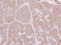 CARD10 Antibody, Novus Biologicals 0.1mg; Unlabeled:Antibodies, Polyclonal