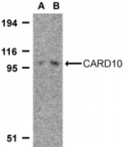 CARD10 Antibody - BSA Free, Novus Biologicals 0.1mg; Unlabeled:Antibodies,