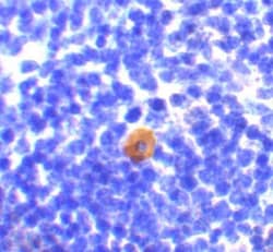 CARD11/CARMA1 Antibody - BSA Free, Novus Biologicals 0.1mg; Unlabeled:Antibodies,