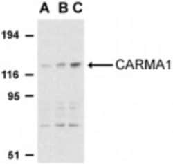 CARD11/CARMA1 Antibody - BSA Free, Novus Biologicals 0.1mg; Unlabeled:Antibodies,
