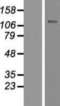Novus Biologicals&trade;&nbsp;CARD14 Overexpression Lysate