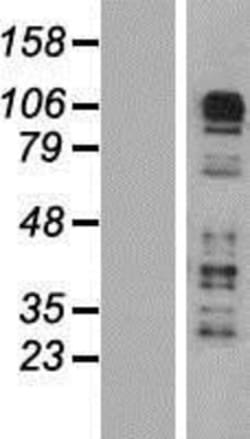 Novus Biologicals&trade;&nbsp;CARD6 Overexpression Lysate