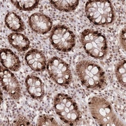 CARD8 Antibody, Novus Biologicals 0.1mL; Unlabeled:Antibodies, Polyclonal
