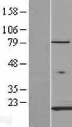 Novus Biologicals&trade;&nbsp;FABP3/H-FABP Overexpression Lysate