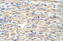CARF/CDKN2AIP Antibody, Novus Biologicals 0.1mg; Unlabeled:Antibodies,